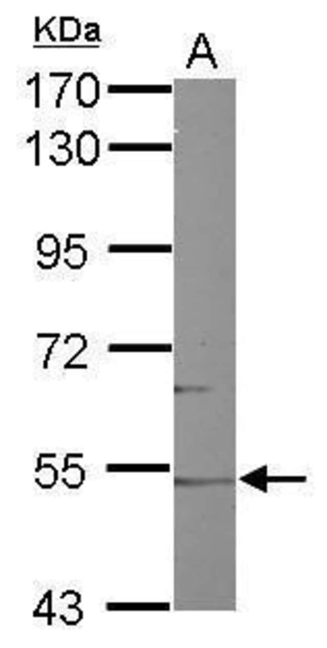 Anti-CYP46A1