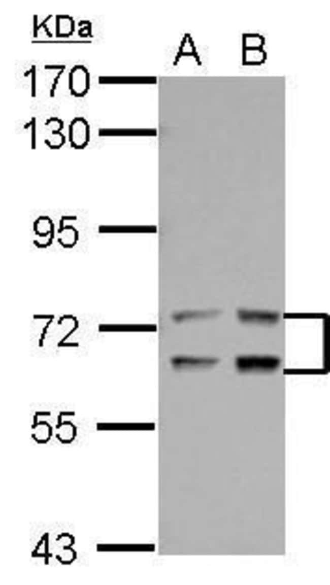 Anti-Leukotriene A4 hydrolase
