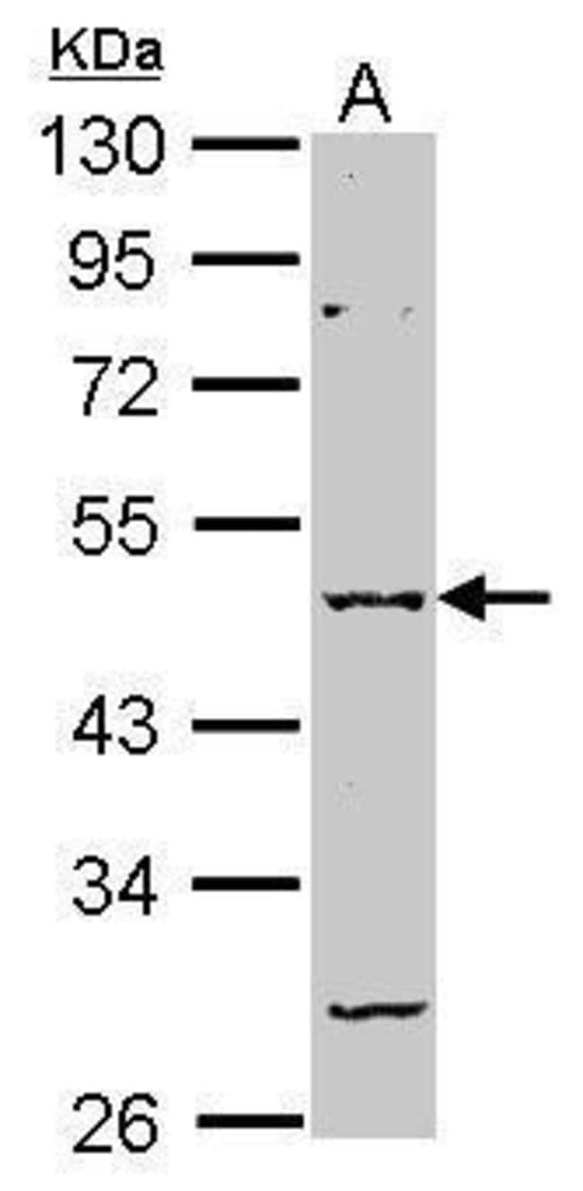 Anti-GABA A Receptor alpha 2