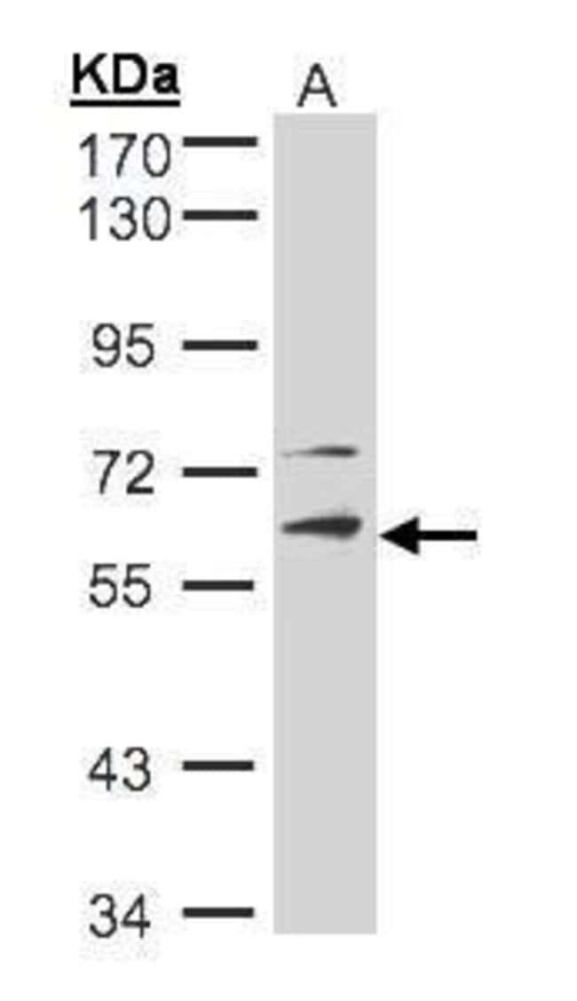Anti-STK33