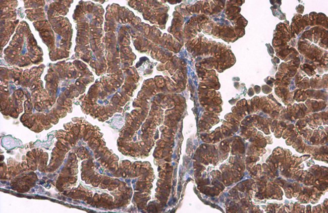 ANTI-ACTIVIN RECEPTOR TYPE IIB