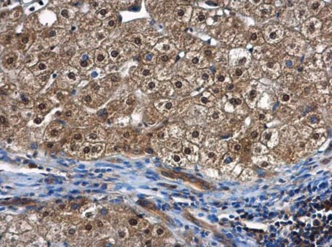 Anti-PSMC5