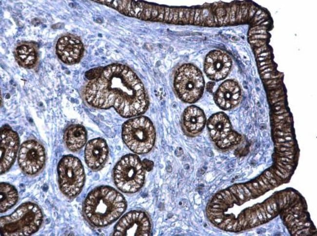 Anti-Cytokeratin 6