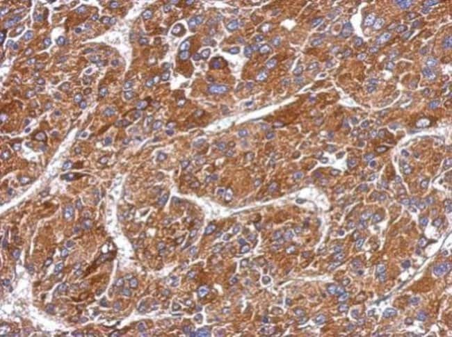 Anti-MMP8