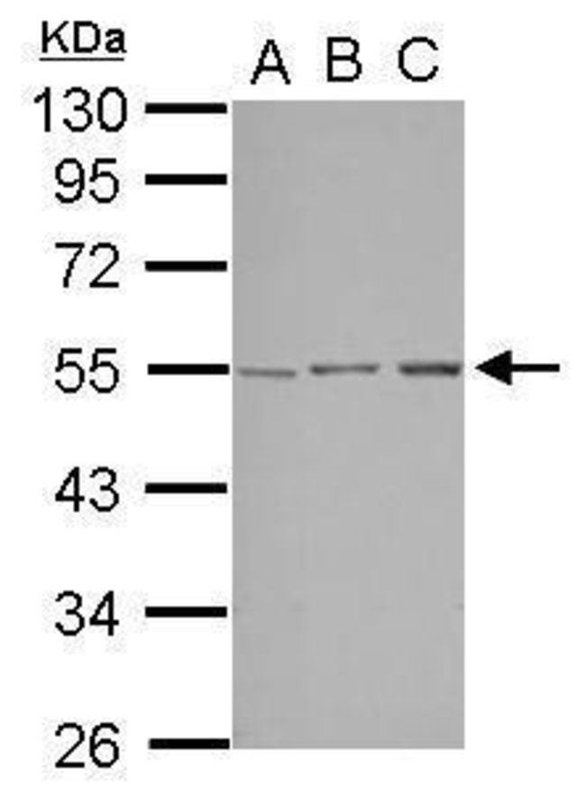 Anti-STK38L