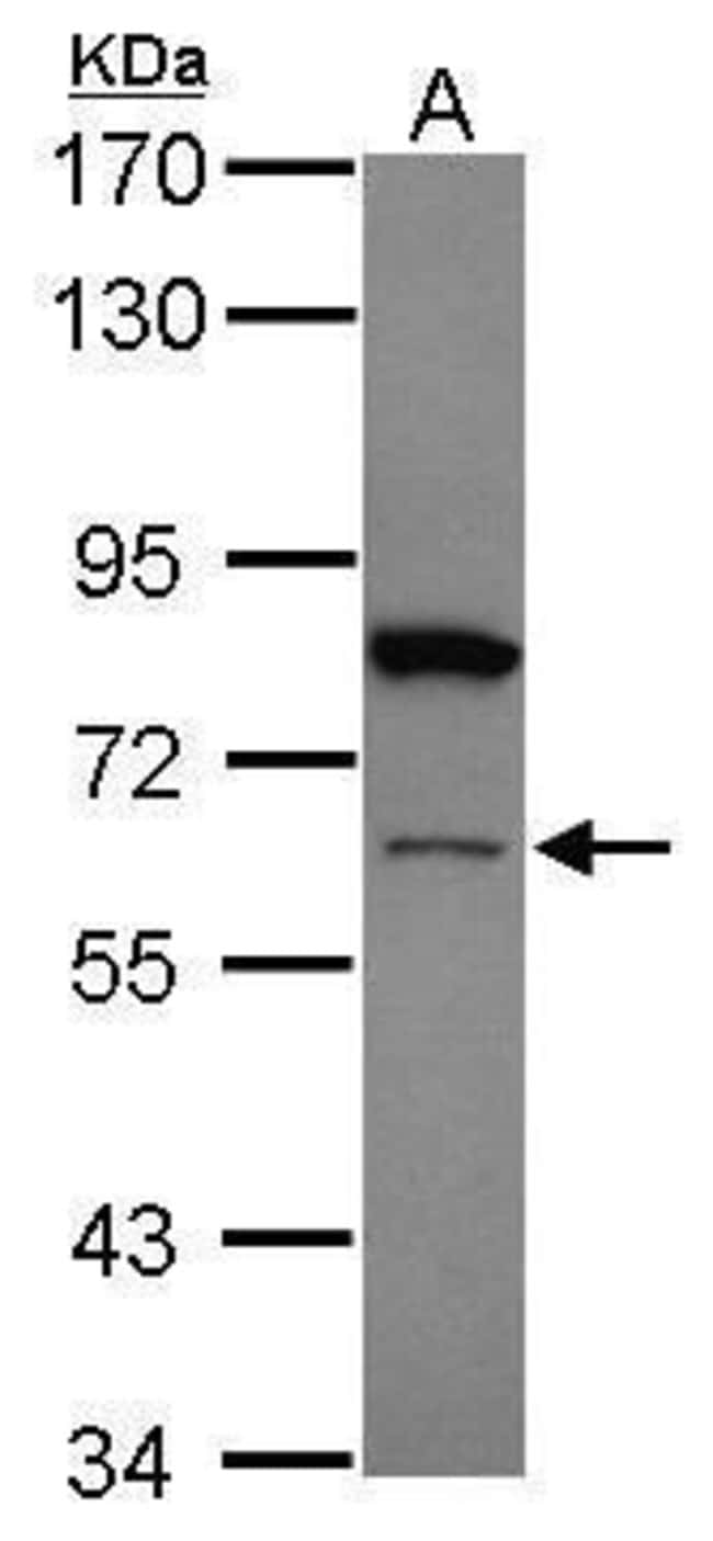 Anti-ZNF449
