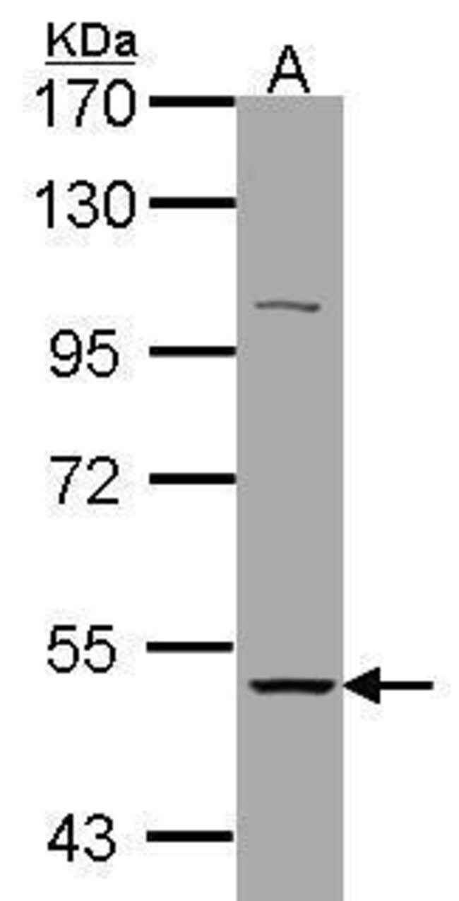 ANTI-NICOTINIC ACETYLCHOLINE RECEPTOR AL