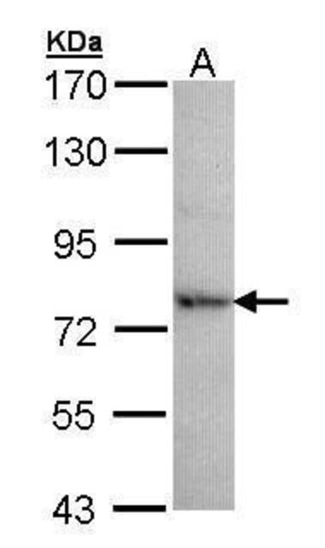 Anti-DDX41