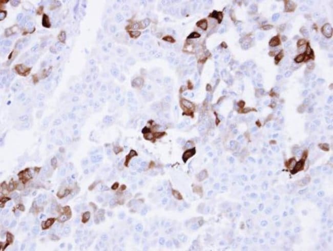 Anti-Carbonic anhydrase 2