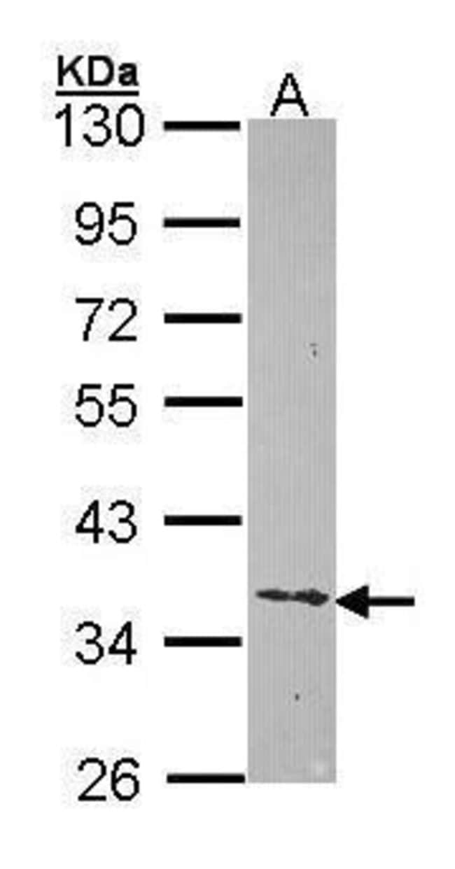 Anti-Ephrin-B2