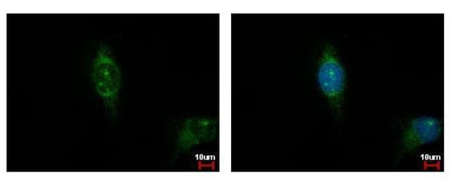 Anti-Casein Kinase 1 alpha 1L