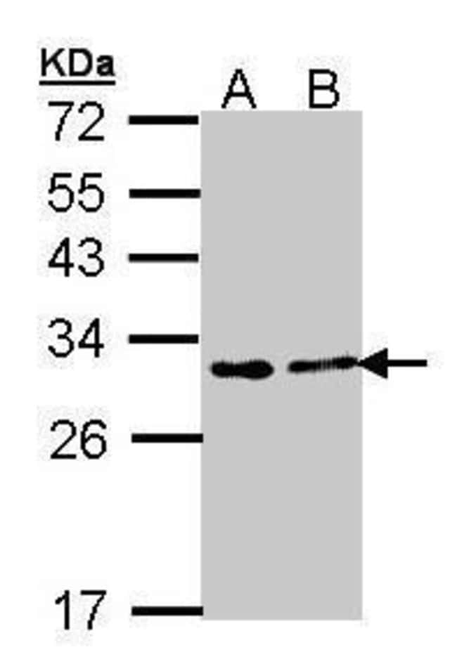 Anti-FKBP25