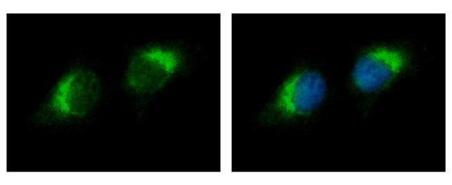 Anti-Ribonuclease A