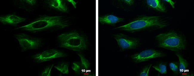 Anti-Cytokeratin 18