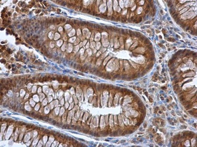 Anti-Selenoprotein P