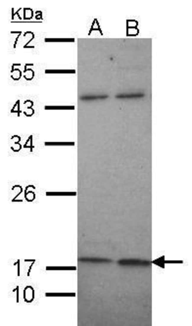 Anti-KCNMB1