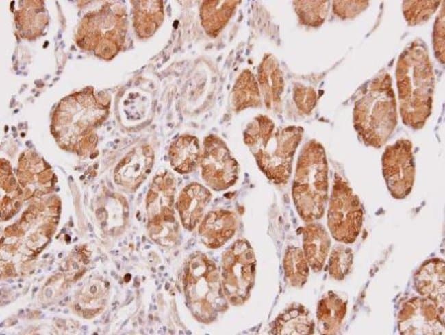 Anti-Cathepsin O