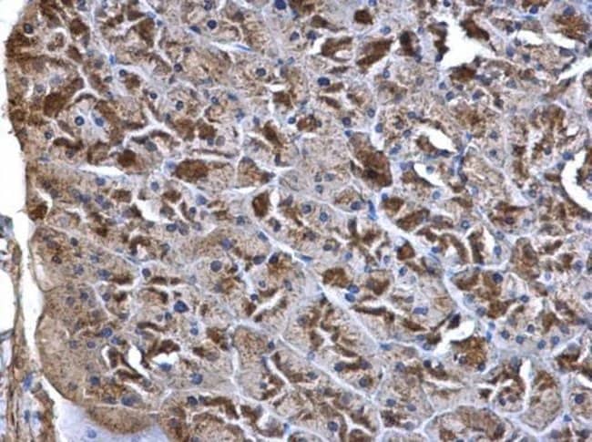 Anti-WNT7A