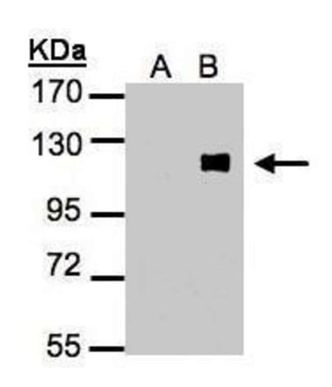 Anti-ZNF281