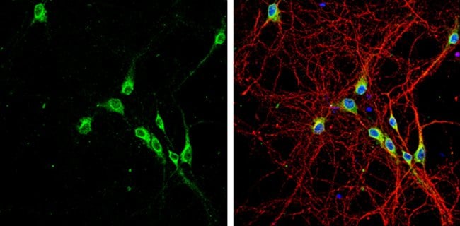 Anti-LGI1