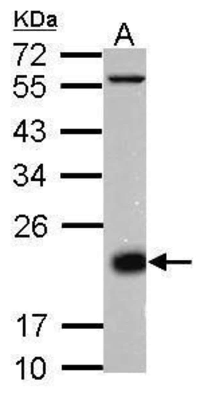 Anti-CD3 delta