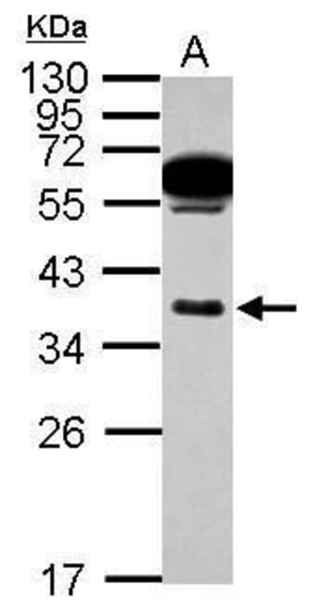 Anti-Mast Cell Chymase