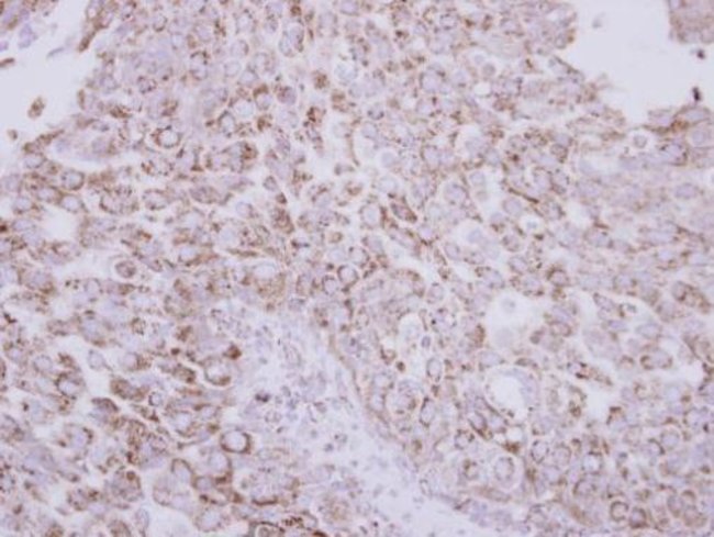 Anti-Protein C