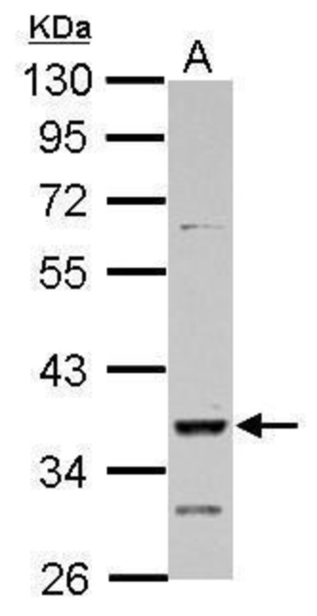 Anti-DMRT1