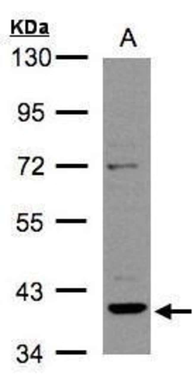 Anti-RAD51B