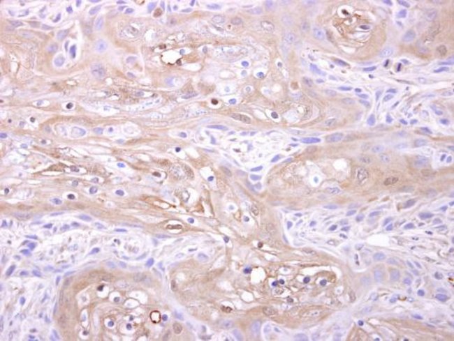 Anti-Adenylate kinase 1