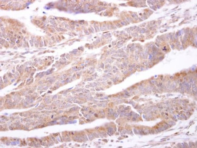 Anti-PTP1B