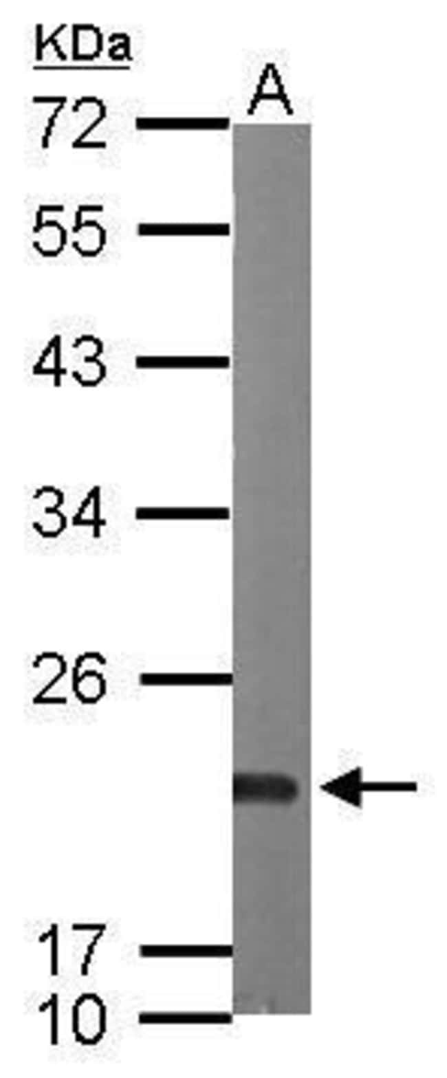 Anti-Sorcin