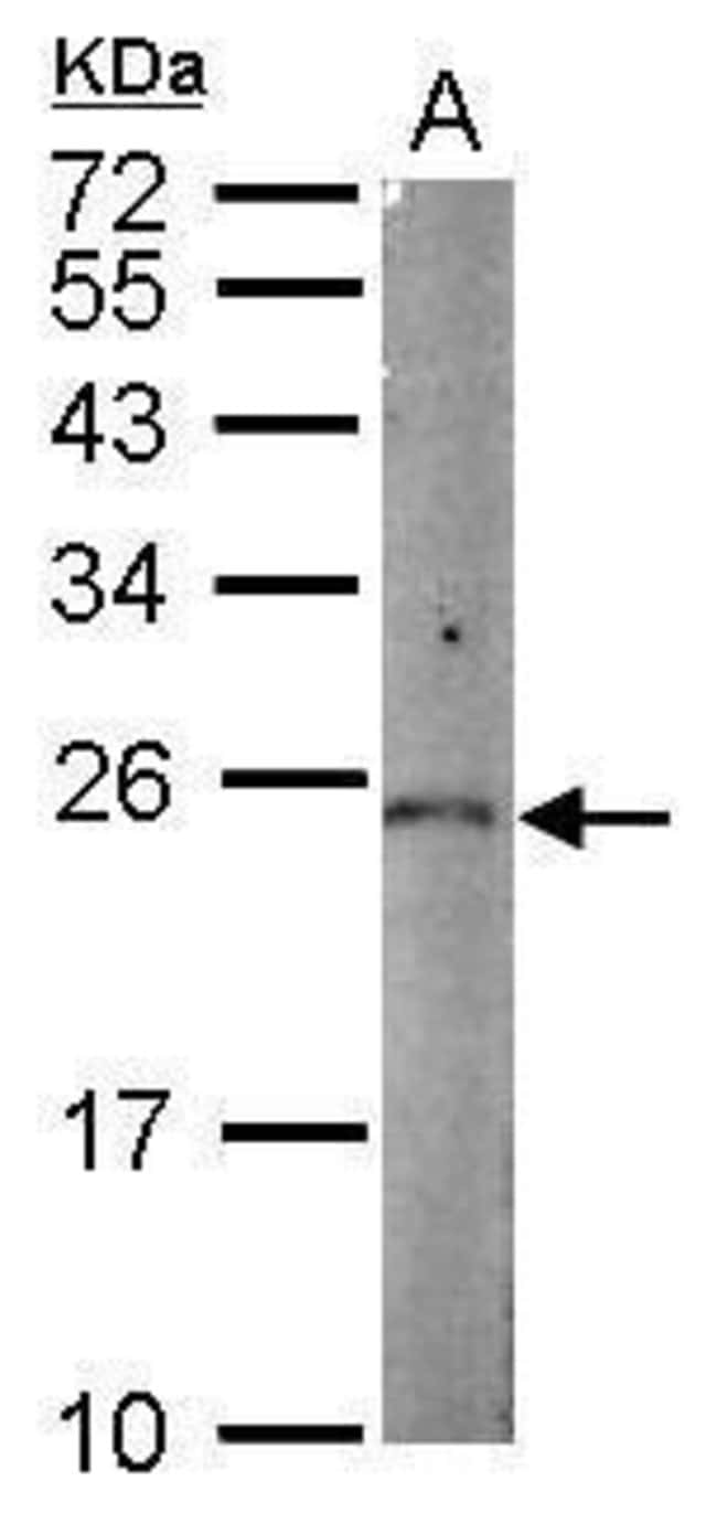 Anti-PGPEP1