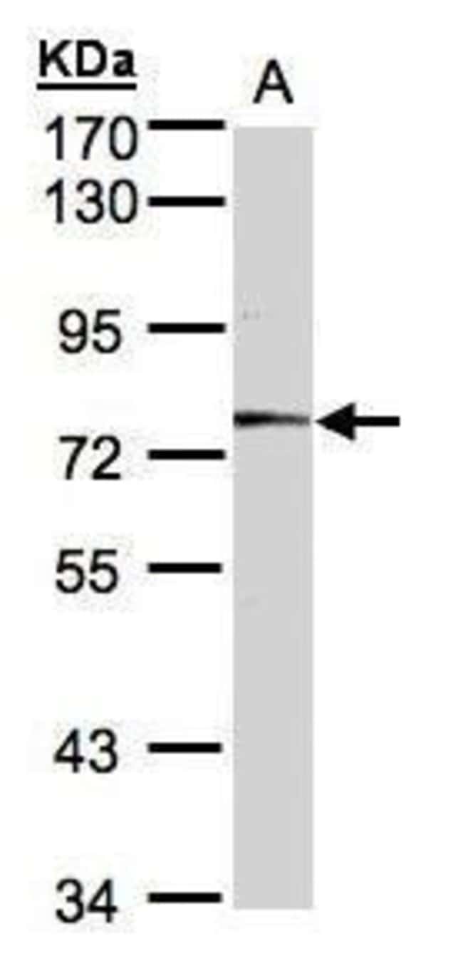 Anti-Meprin alpha