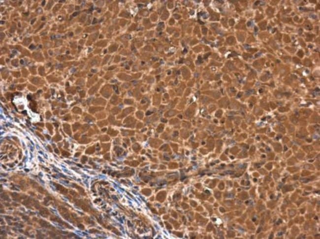 Anti-calponin 3