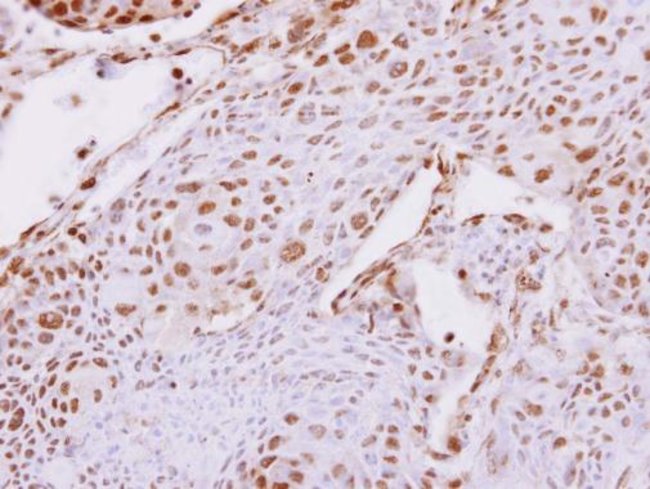 Anti-Carboxypeptidase E