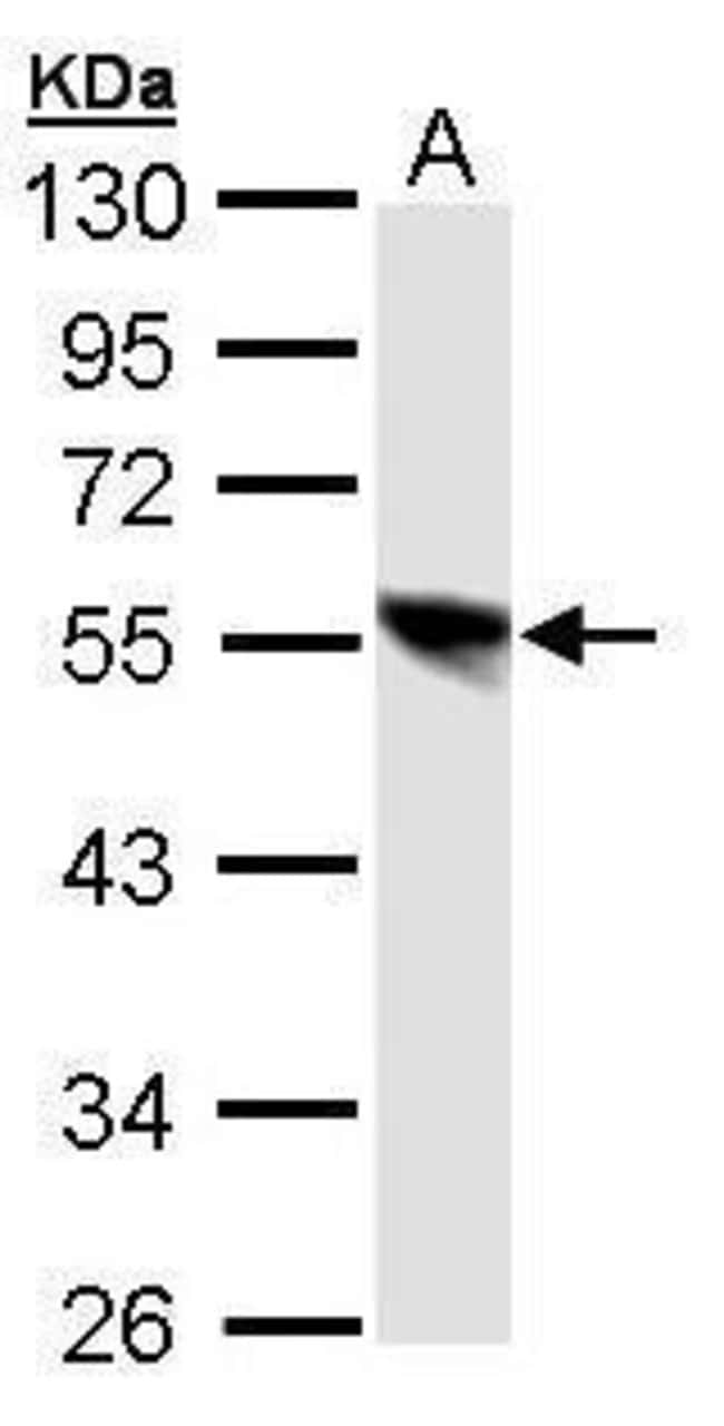 Anti-DP1