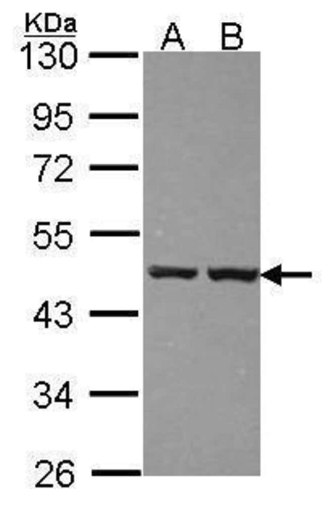 Anti-ZNF396