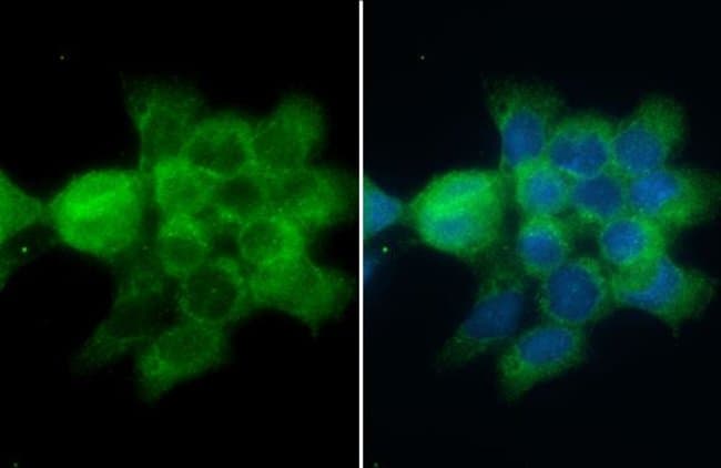 Anti-CD2AP