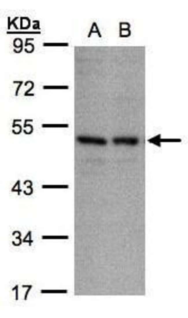 Anti-CD158e