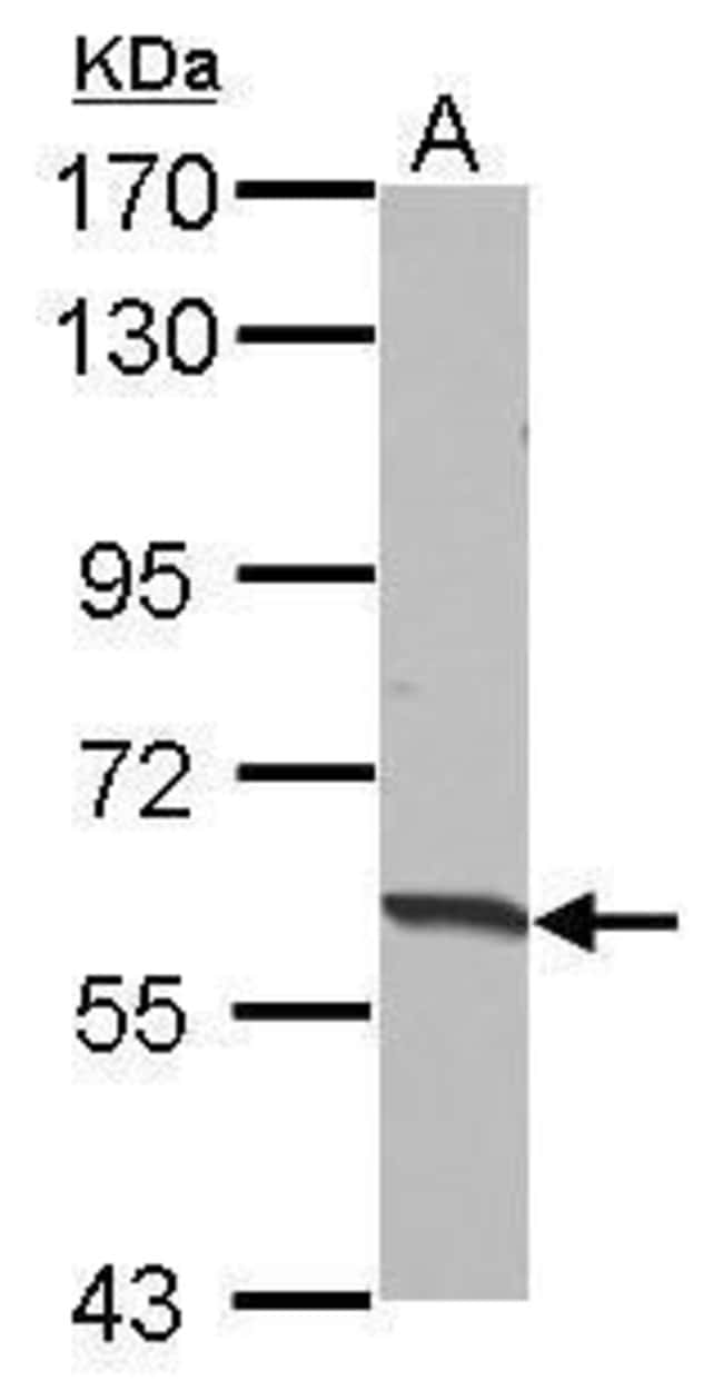Anti-HABP2
