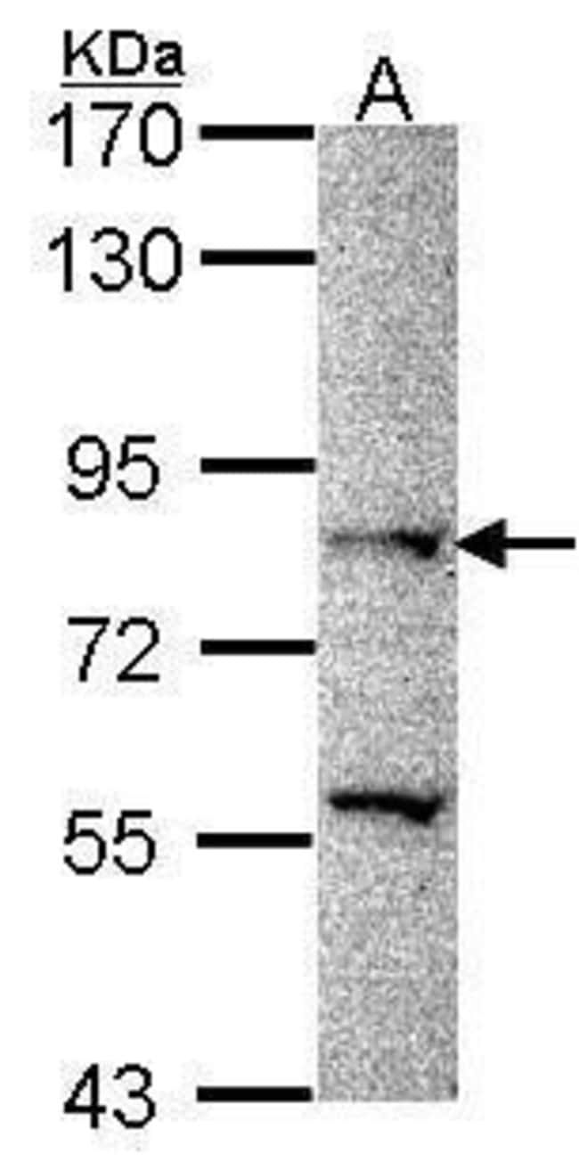 Anti-PRDM8