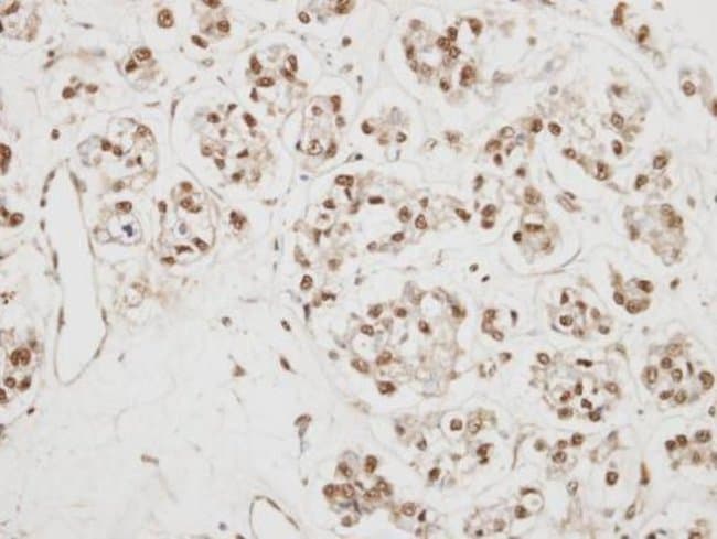 Anti-NCBP1