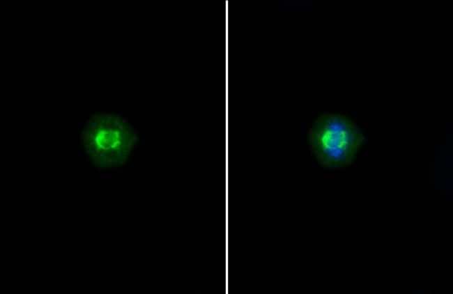 Anti-TRF1