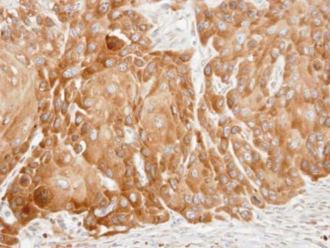 Anti-VDP/p115