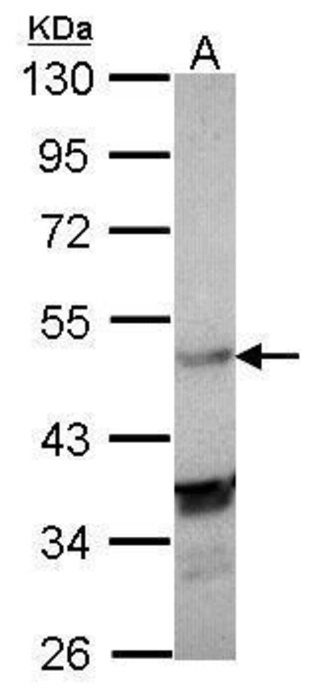 Anti-LXR-alpha