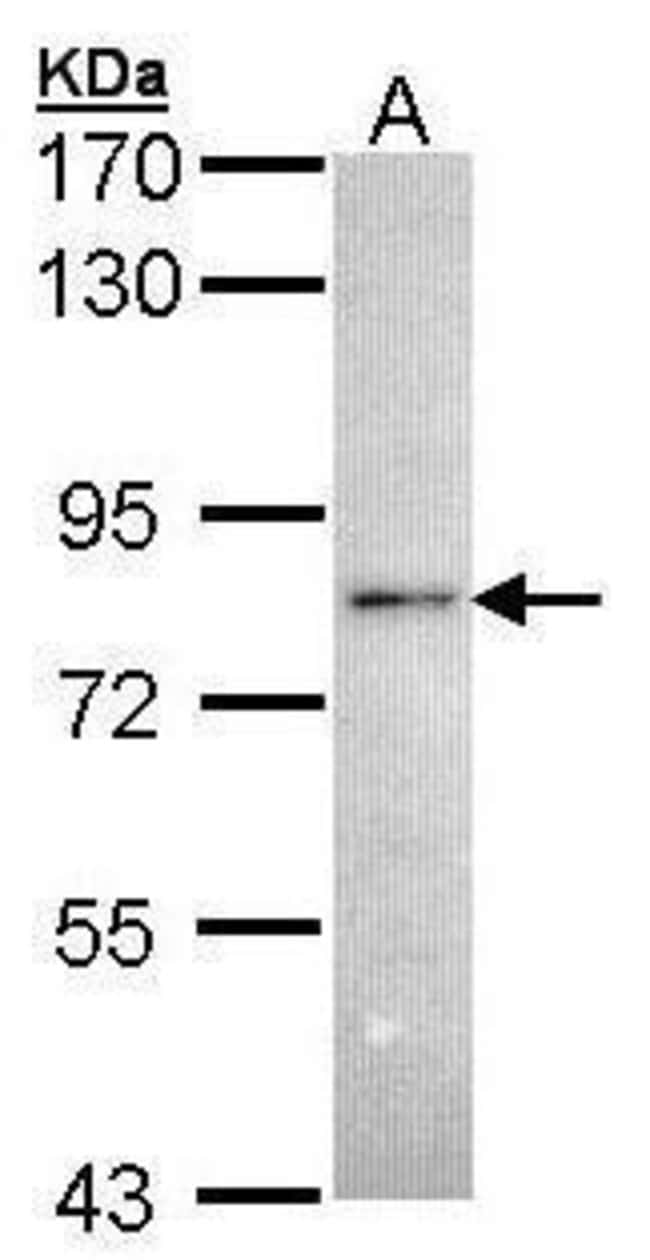 Anti-RNF6
