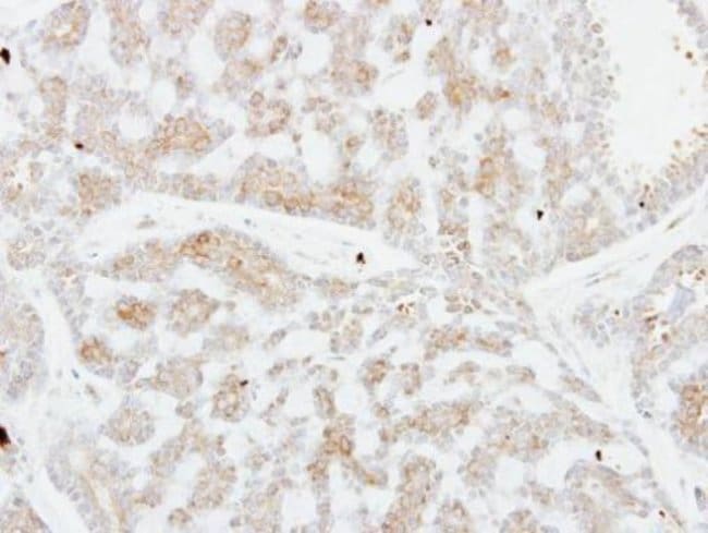 Anti-FSTL1