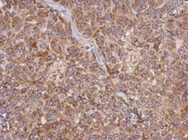 Anti-Apolipoprotein L1
