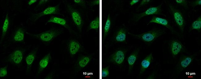 Anti-hnRNP R